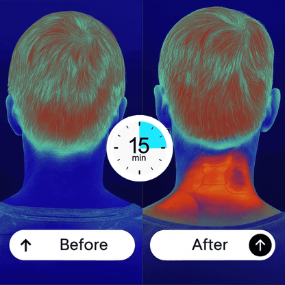 Liftrion NeuroTherm™